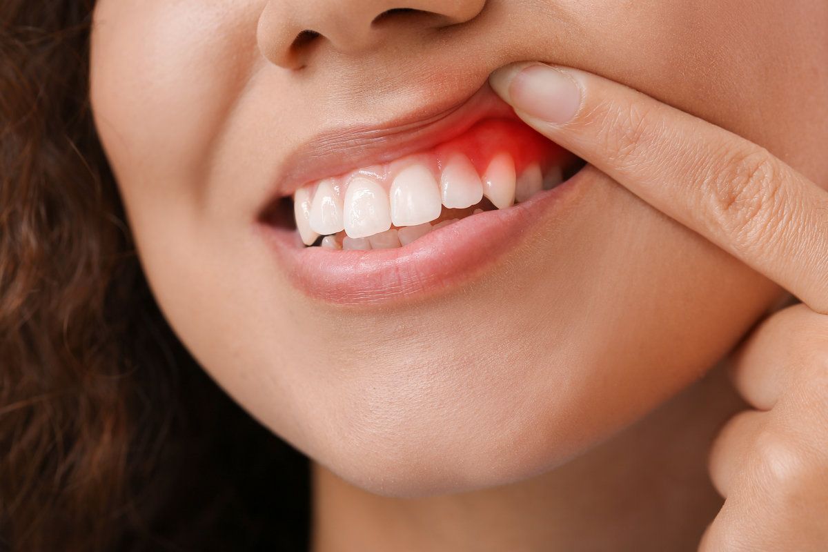 woman showing her gums
