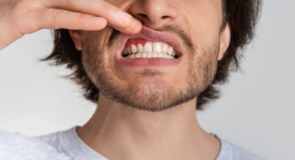 Man touch mouth with painful expression of toothache