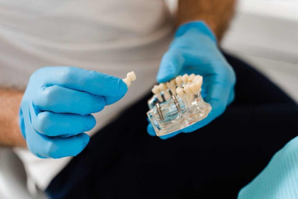 Artificial plastic jaw with dental implants close-up. Dental prosthetics and implants. Dental prosthetics consultation with dentist for patient woman in dentistry.