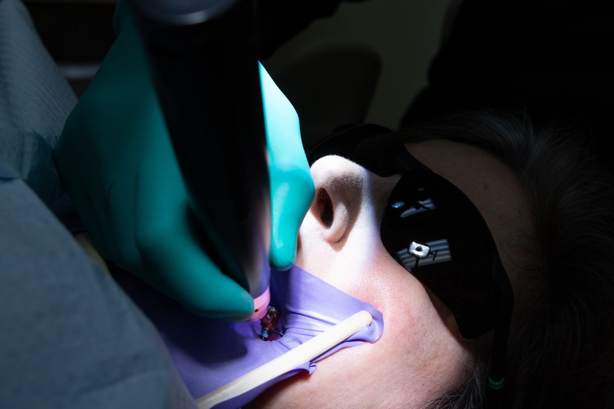 Patient receiving root canal therapy during endodontic procedure in dental clinic. with the hands, dental instruments, mirror, rubber dam isolation, and tweezers